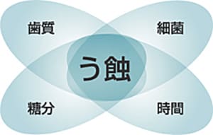 むし歯のメカニズム