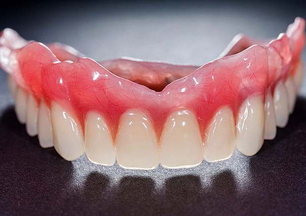 保険と自費の入れ歯の違い<