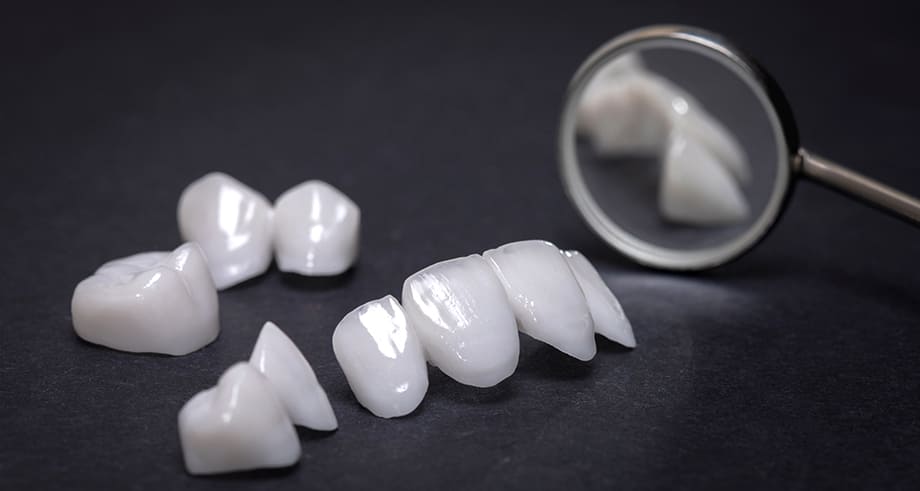 美しく、身体に優しい審美的なセラミック治療