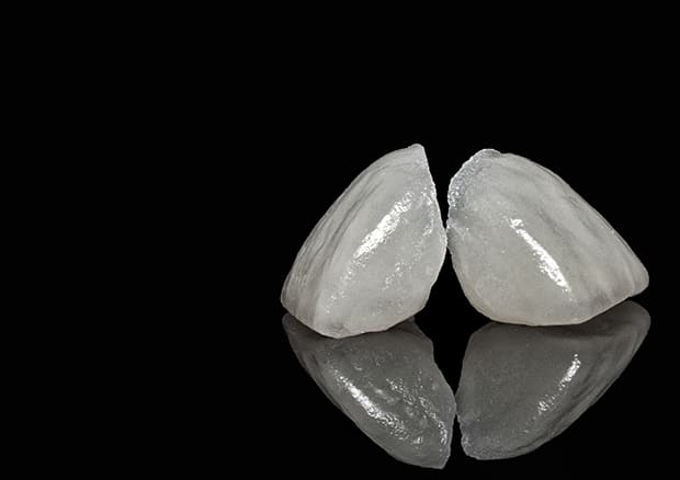 見た目が綺麗で身体に優しいセラミックス治療