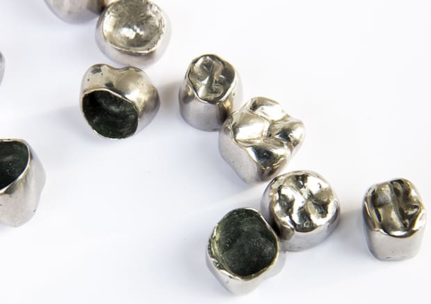 銀歯は金属アレルギーの原因になる？！