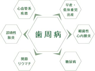 歯周病が全身へと影響をおよぼすメカニズム