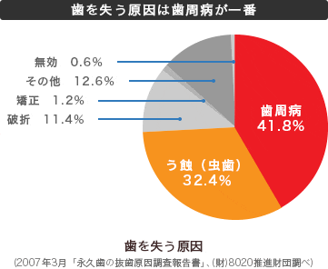 歯を失う原因