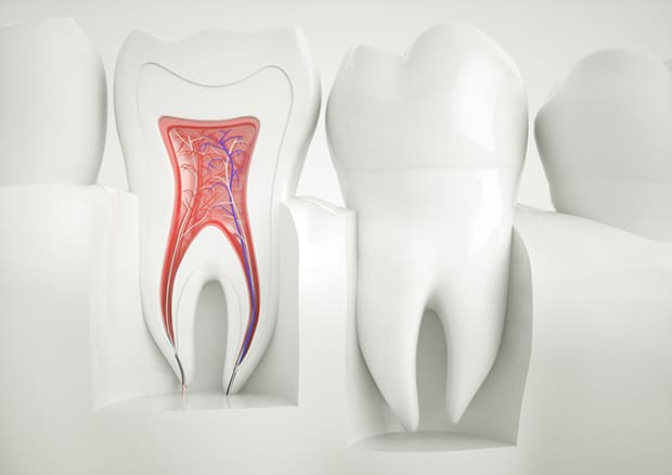 根管治療が必要になる原因は？