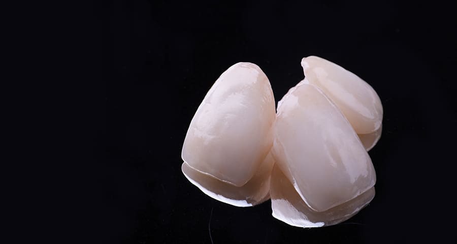 審美セラミック治療